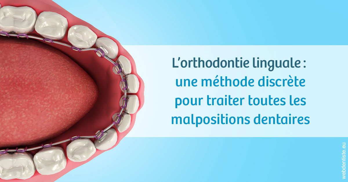 https://dr-salles-eric.chirurgiens-dentistes.fr/L'orthodontie linguale 1
