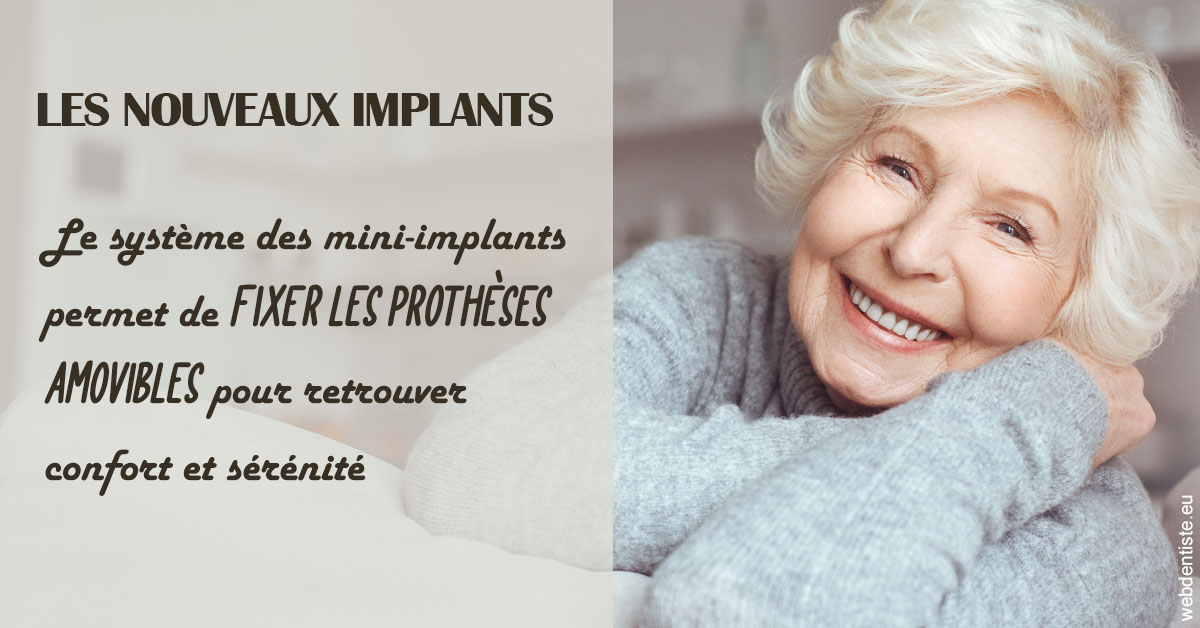 https://dr-salles-eric.chirurgiens-dentistes.fr/Les nouveaux implants 1