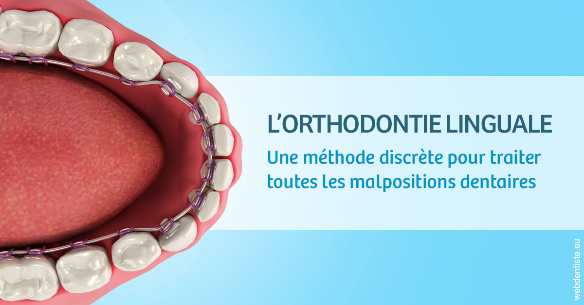 https://dr-salles-eric.chirurgiens-dentistes.fr/L'orthodontie linguale 1