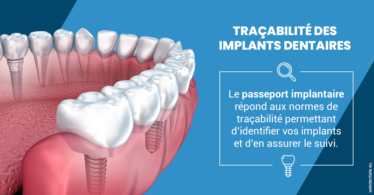 https://dr-salles-eric.chirurgiens-dentistes.fr/T2 2023 - Traçabilité des implants 1
