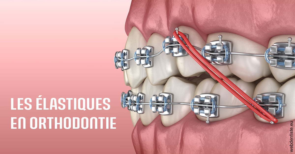 https://dr-salles-eric.chirurgiens-dentistes.fr/Elastiques orthodontie 2