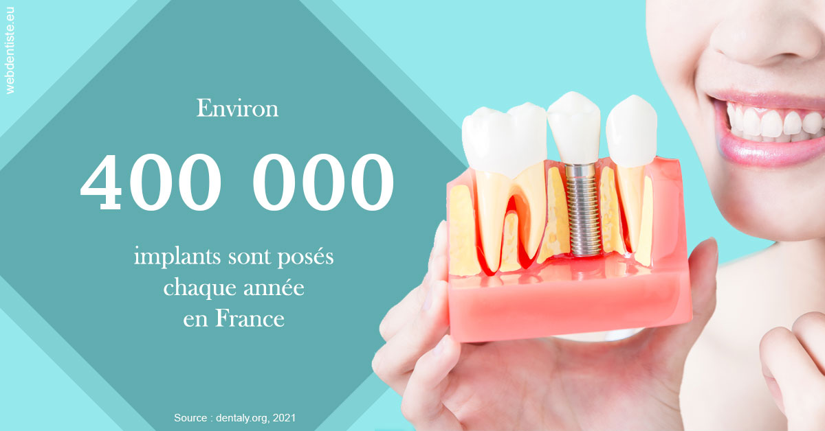 https://dr-salles-eric.chirurgiens-dentistes.fr/Pose d'implants en France 2